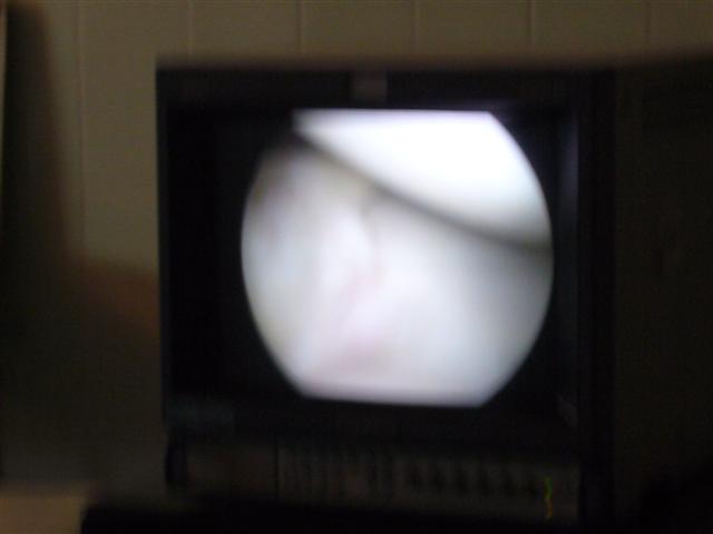 Travel - Bolivia - Knee Operation